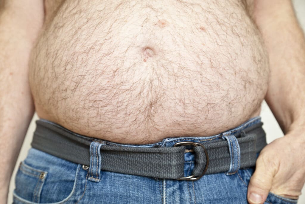 Man with fat hairy belly showing above his jeans and hand in pocket